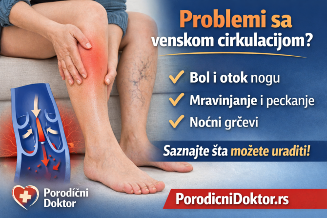 Problemi sa venskom cirkulacijom: Da li su bol, mravinjanje i otok nogu znak upozorenja?